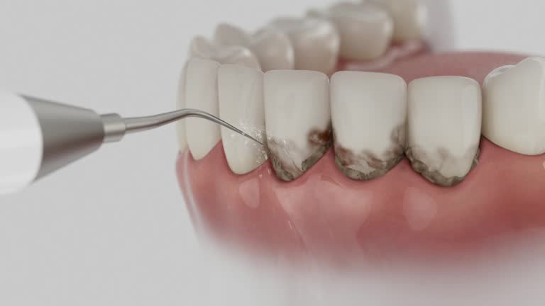 Reliable Dental contractor in Mountain House, CA by Dentist Open Now